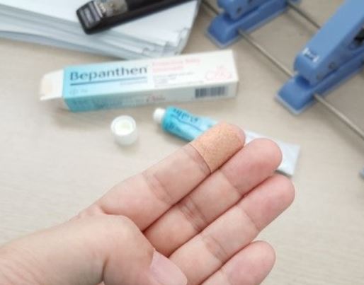 손 베이는 꿈 해몽