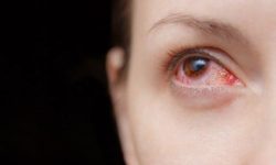 눈이 충혈되는 꿈의 의미