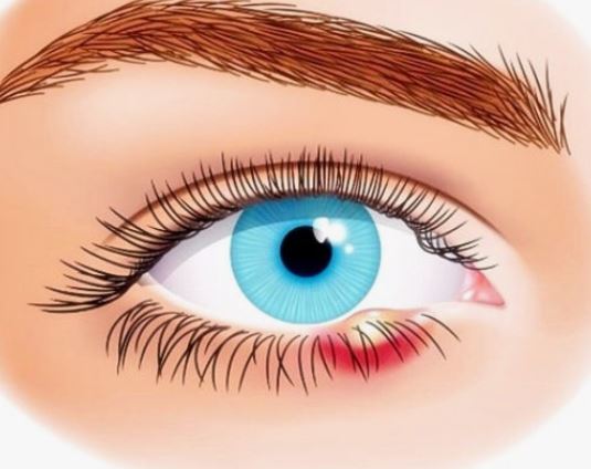 눈에 다래끼 나는 꿈의 의미