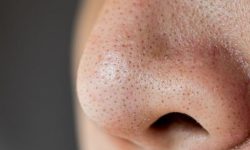 코 피지 짜는 꿈의 의미(해몽) 코 피지 짜는 꿈의 의미