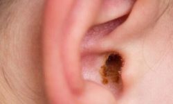 귀파는 꿈의 의미(해몽) 귀파는 꿈의 의미