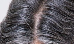 흰머리 뽑는 꿈의 의미