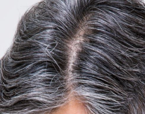 흰머리 뽑는 꿈의 의미