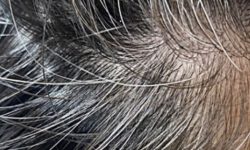 흰머리 보는 꿈의 의미