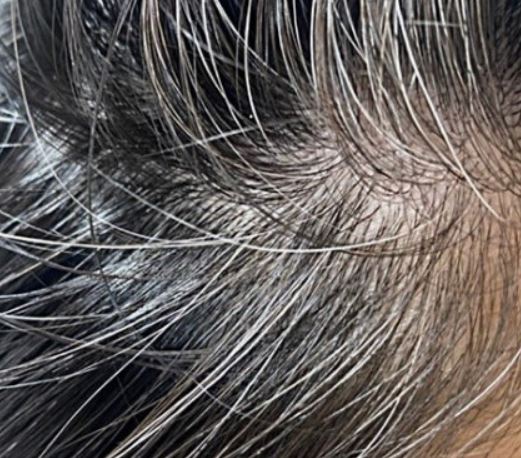 흰머리 보는 꿈의 의미