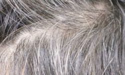 흰머리 뽑아주는 꿈의 의미