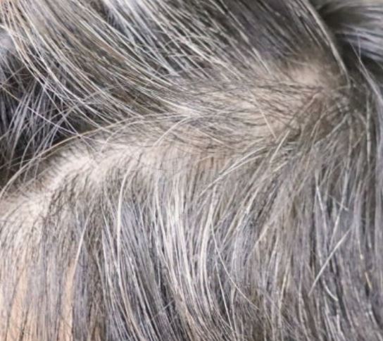 흰머리 뽑아주는 꿈의 의미