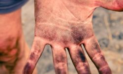 손 다치는 꿈의 의미(태몽, 재물, 운세)