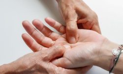 손에 화상 입는 꿈의 의미