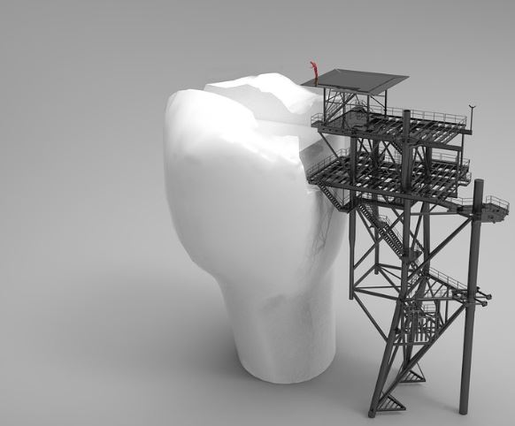 아랫니 흔들리는 꿈의 의미