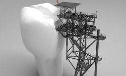 이빨이 흔들리는 꿈의 의미