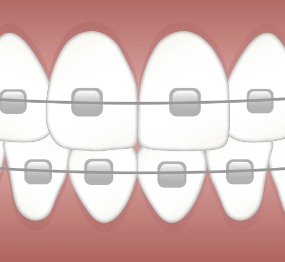 교정기를 착용하는 꿈의 의미
