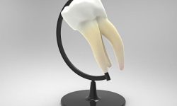 아래 어금니 빼는 꿈