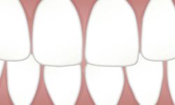 어금니 뽑는 꿈의 의미는?(해몽, 태몽, 재물, 운세) 어금니 뽑는 꿈의 의미
