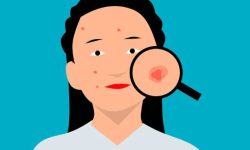 얼굴에 여드름 나는 꿈의 의미