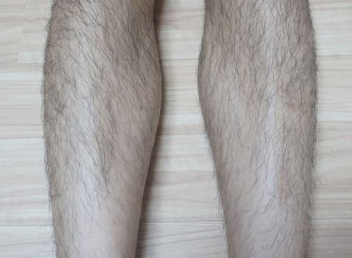 다리 털 뽑는 꿈의 의미